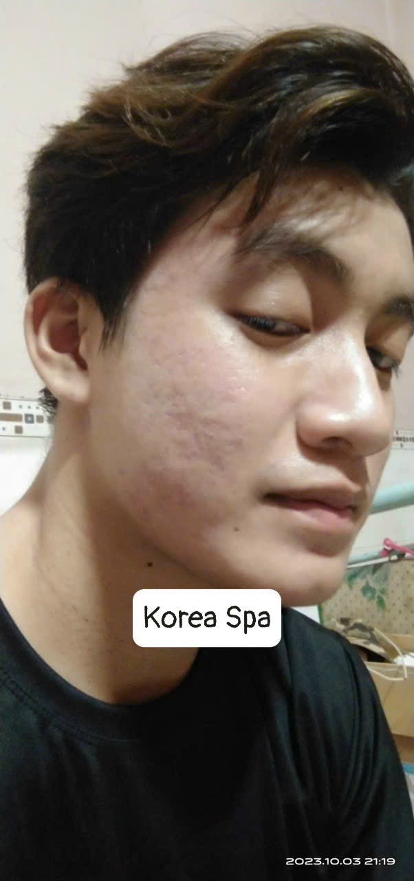 Korea Spa - Spa Chuyên điều trị mụn nám tàn nhang và tắm trắng tại Đường Phạm Thị Giây Hóc Môn