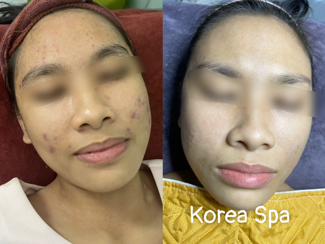 Korea Spa - Spa Chuyên điều trị mụn nám tàn nhang và tắm trắng tại Đường Phạm Thị Giây Hóc Môn